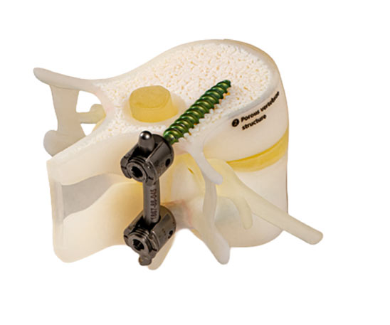 BoneMatrix